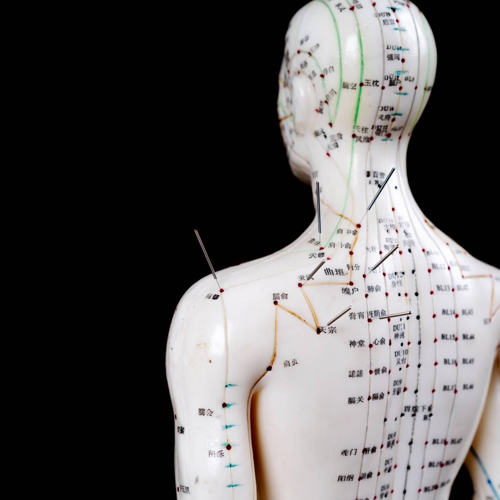 male acupuncture model with needles on a black background