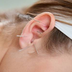 Second Spring Social Peri Menopause Ear Acupuncture